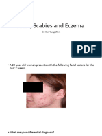 T6 Acne, Scabies, Eczema