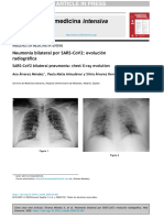 NeumoníabilateralporSARS-CoV2 Evolución