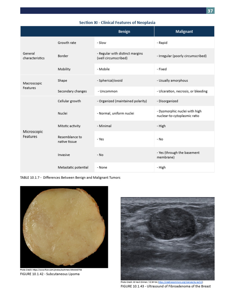 Section XI - Clinical Features of Neoplasia | PDF | Adenoma | Neoplasms