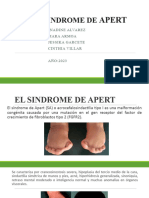 Sindrome de Apert