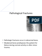 Pathologicalfractures 170201065538
