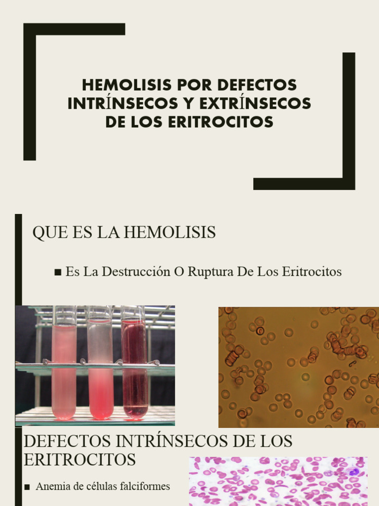 Hemolisis Por Defectos Intrínsecos y Extrínsecos Eritrositos | PDF ...