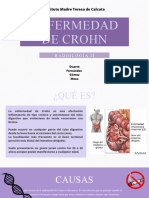 Enfermedad de Crohn