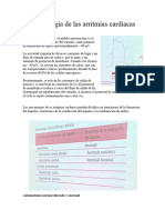 Fisiopatología de Las Arritmias Cardiacas: Automatismo Normal Alterado y Anormal