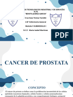 Cancer de Prostata