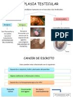 Neoplasia Testicular