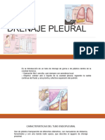 Drenaje Pleural