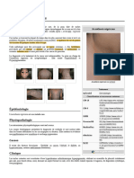 Acanthosis Nigricans 