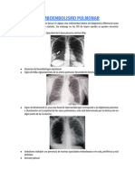 Tromboembolismo Pulmonar