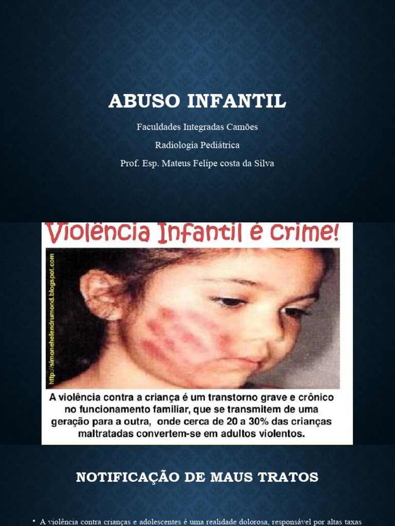 Identificação e Notificação de Abuso Infantil | PDF