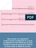 CC - EKG (18.5 X 10.5 CM) (10 X 9 CM)