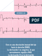 Determine El Eje