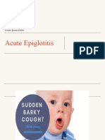 Acute Epiglottitis