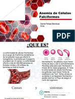 Anemia de Células Falciformes