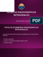 Técnicas Radiográficas Intraorales