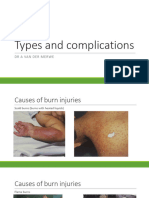 Types and Complications Burn (Physiotherapy)