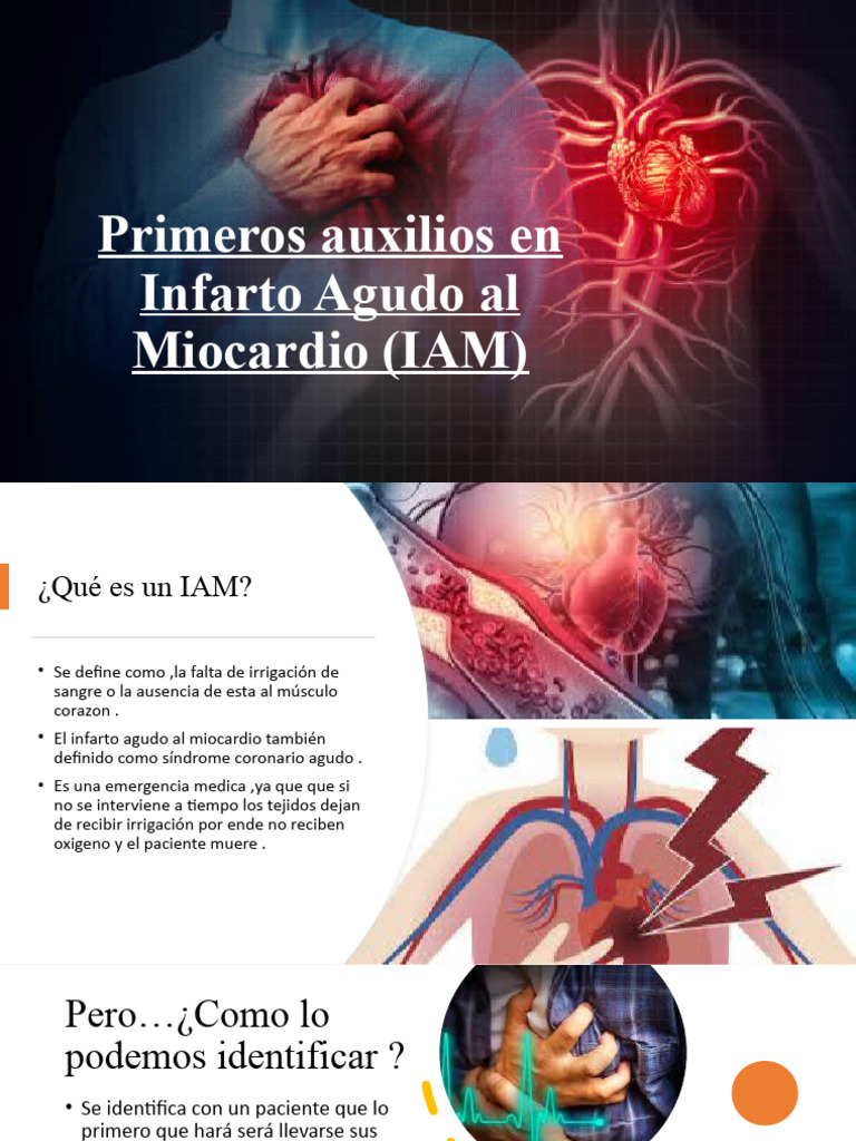 IAM 2 | PDF | Infarto de miocardio | Emergencias Médicas