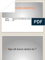 Karies Dentis