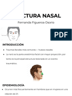 Fractura Nasal