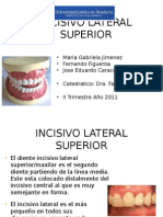 Incisivo Superior Lateral