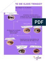 Tipos de Ojos