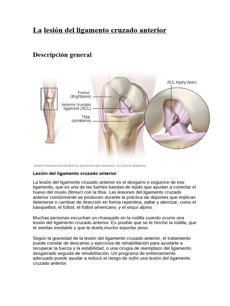 Lesiones de Ligamento Cruzado Anterior | PDF | Rodilla | Sistema ...