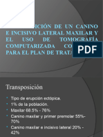 Artículo Transposición de Lateral y Canino