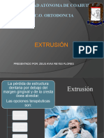 Extrusión Guiada