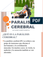 Paralisis Cerebral 2