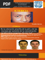 Coluria: Bilirrubina en Orina | PDF | Gastroenterología | Rtt