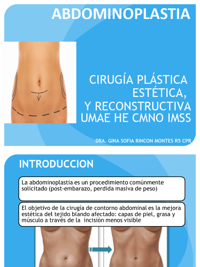 clasificaci-n-y-t-cnicas-de-abdominoplastia-pdf-abdomen-anatom-a