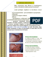 25438188-CIROZA-HEPATICA