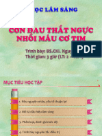 Đau thắt ngực