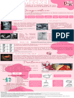 Diverticulo de Meckel Pediatria