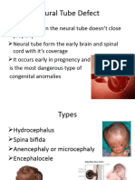 Neural Tube Defect