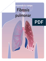 ES-PocketDoktor EPID FibrosisPulmonar