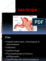 Ulcer Gastrique - Cher
