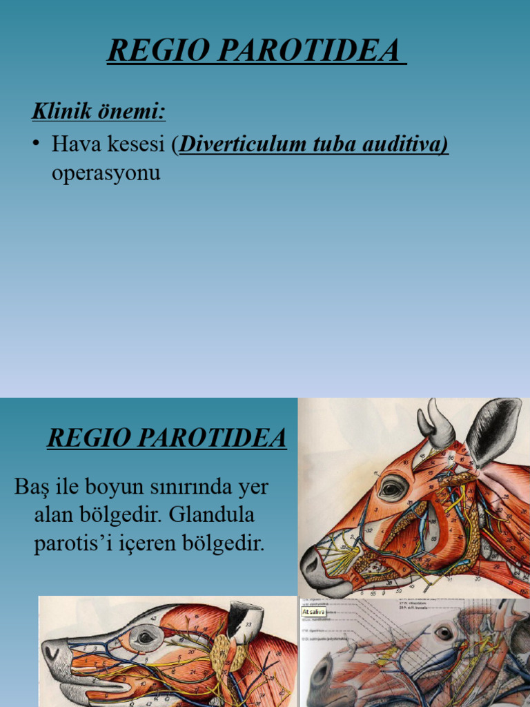 7Diverticulum Tuba Auditiva PDF