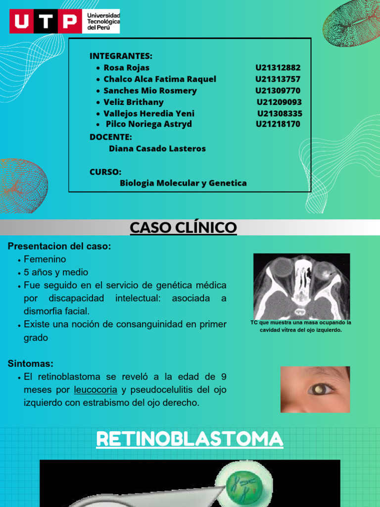 retinoblastoma-bmyg-pdf-medicina-enfermedades-y-trastornos