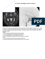 Cazuri Clinice La Tema Bolile Cerebrale Vasculare BCV. Accidente Vasculare Cerebrale AVC - 1