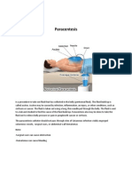 paracentesis