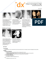 Hilum Overlay Sign in Chest Imaging | PDF