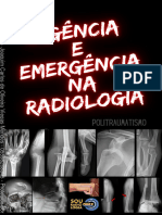 Urgencia e Emergencia Na Radiologia