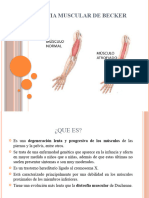 Sindrome de Becker Trabajo Atencion Sanitaria