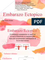 Embarazo_ectopico_Gerito