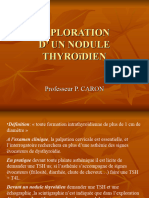 Thyroide Nodule Caron