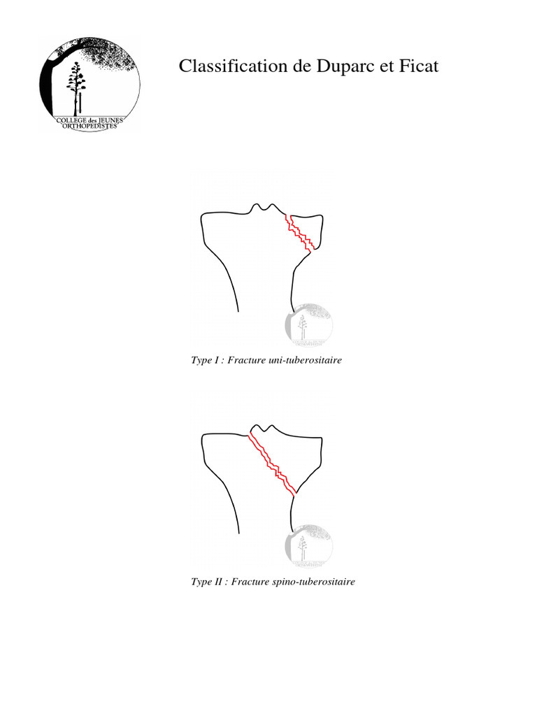 Classification de Dghhuparc Et Ficat | PDF