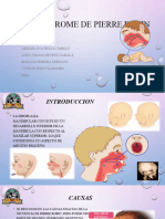 Sindrome de Pierre Robin (5'