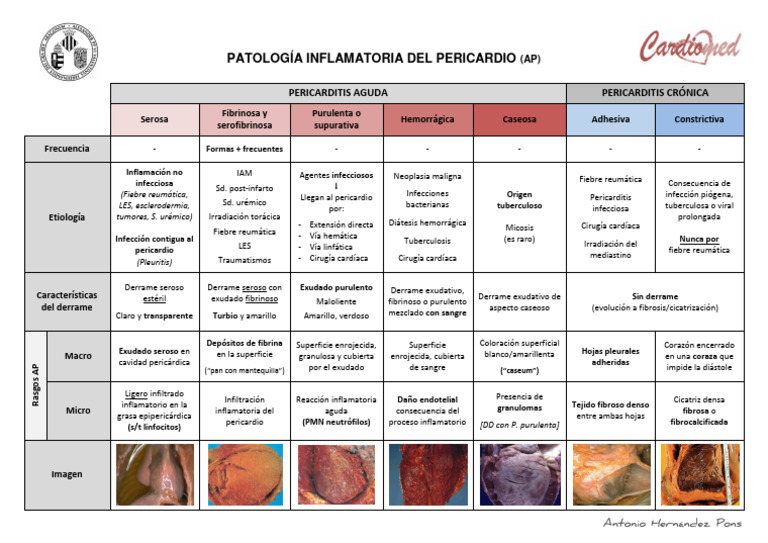 Clasificación de Pericarditis Inflamatorias | PDF