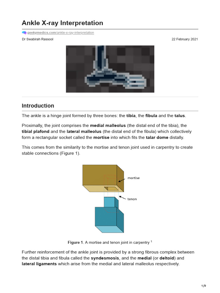 Ankle XRay Interpretation PDF Ankle Musculoskeletal System